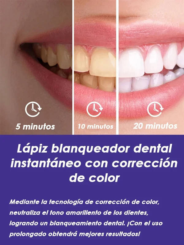 allesxl-32863507
